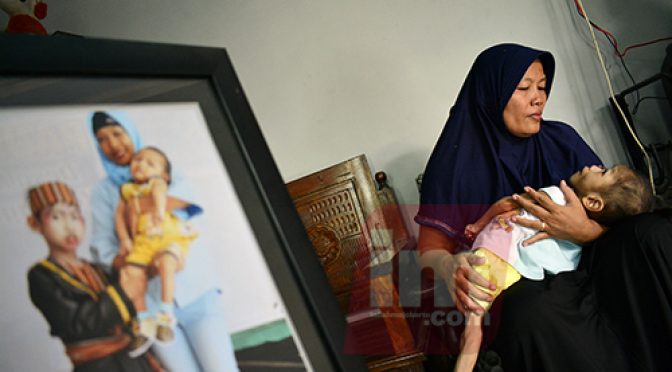Fajar, Balita di Mojokerto Sejak Lahir Mengalami Keterbatasan Fisik