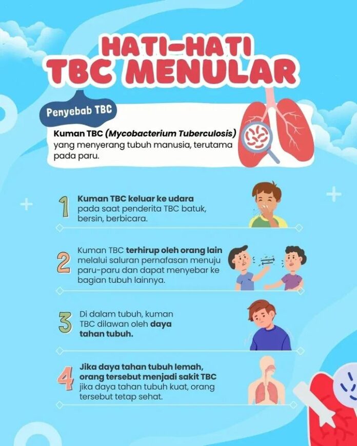 Waspada terhadap penularan TBC.